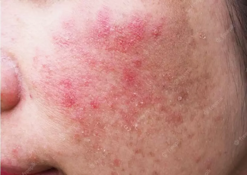 manfaat teh chamomile untuk wajah © berbagai sumber manfaat teh chamomile untuk wajah © berbagai sumber