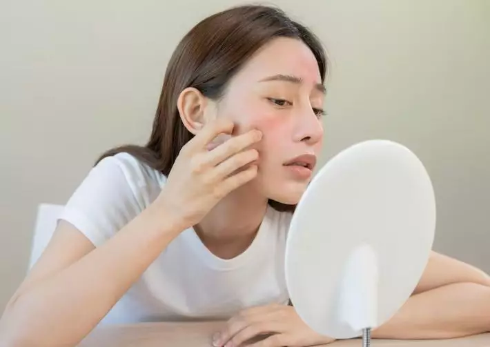 manfaat teh chamomile untuk wajah © berbagai sumber manfaat teh chamomile untuk wajah © berbagai sumber