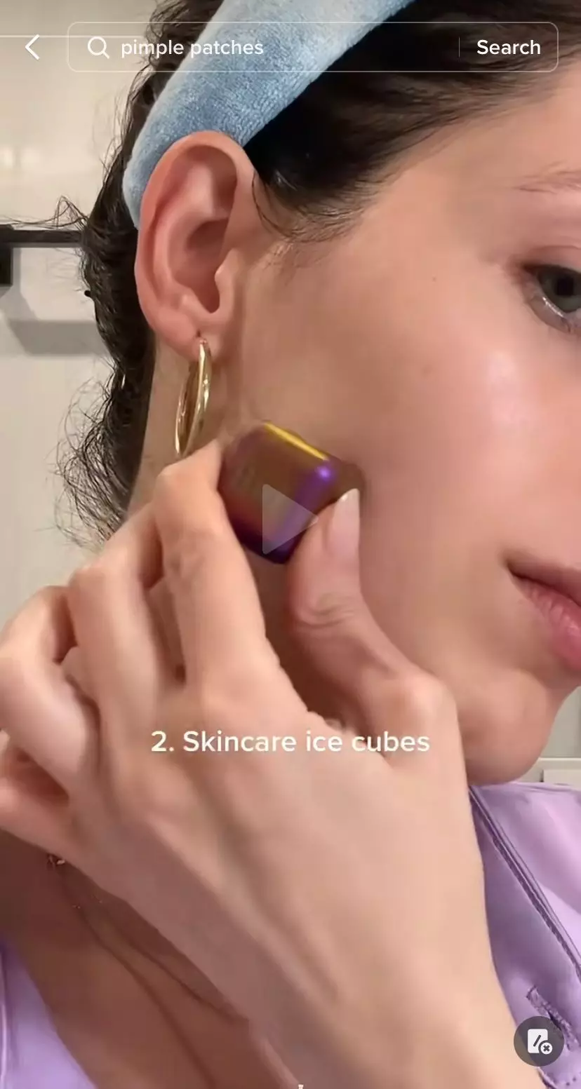 trik mudah atasi jerawat matang bopeng © 2023 berbagai sumber