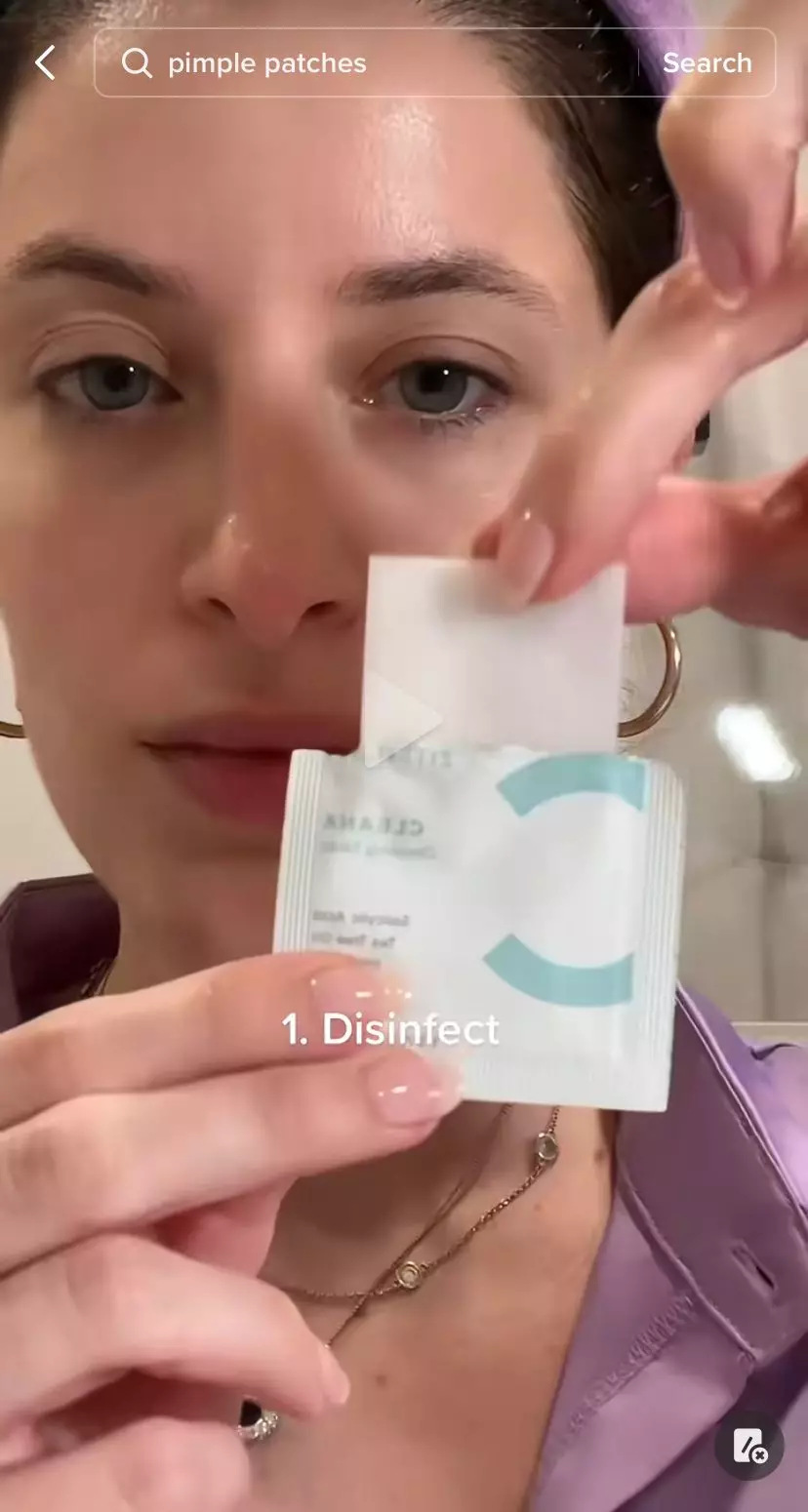 trik mudah atasi jerawat matang bopeng © 2023 berbagai sumber