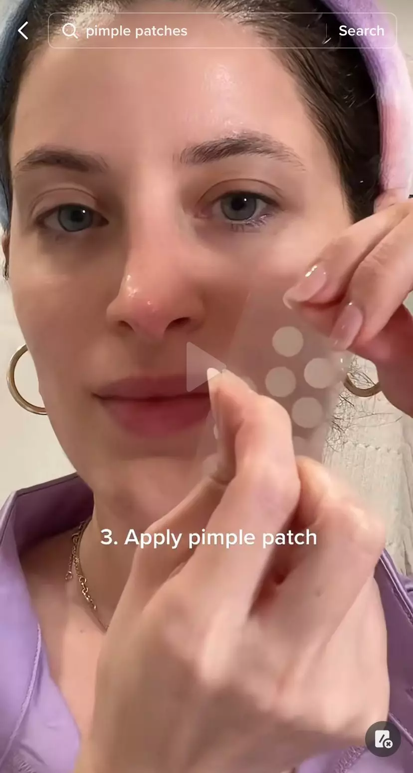 trik mudah atasi jerawat matang bopeng © 2023 berbagai sumber