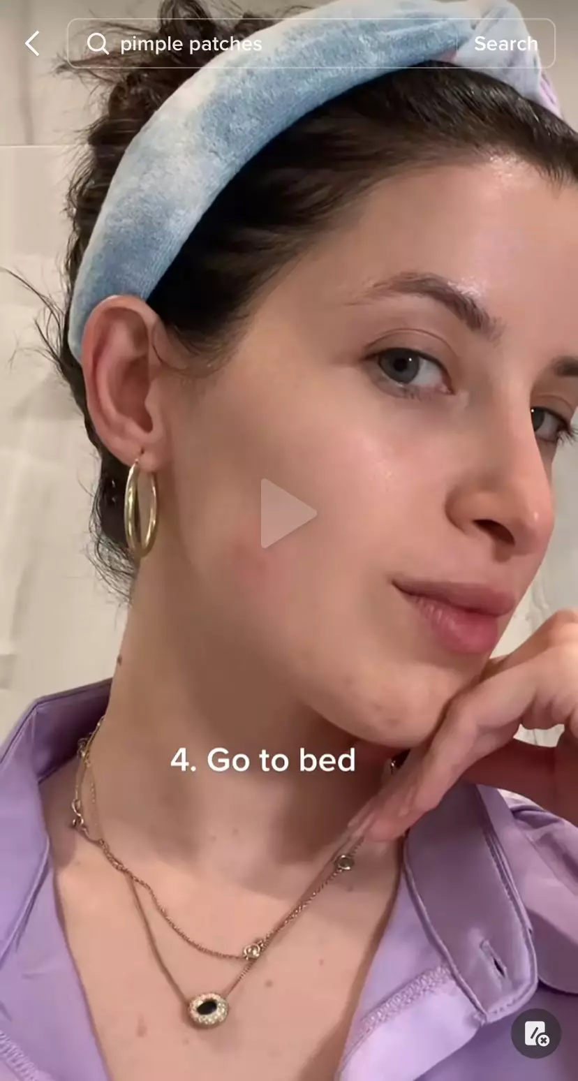 trik mudah atasi jerawat matang bopeng © 2023 berbagai sumber