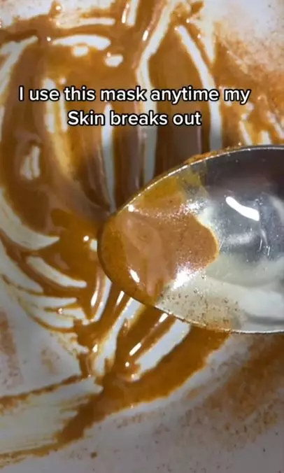 Cara atasi wajah breakout cuma butuh 3 bahan dapur Berbagai sumber Cara atasi wajah breakout cuma butuh 3 bahan dapur Berbagai sumber