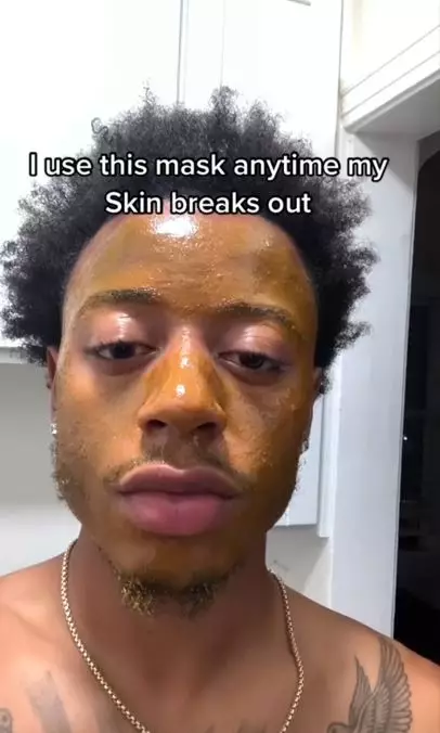 Cara atasi wajah breakout cuma butuh 3 bahan dapur Berbagai sumber Cara atasi wajah breakout cuma butuh 3 bahan dapur Berbagai sumber