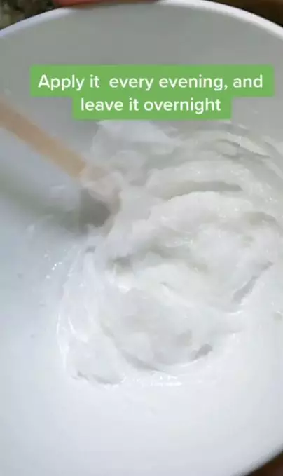 Cara membuat eye cream untuk atasi kantung mata hitam pakai 2 bahan alami Berbagai sumber Cara membuat eye cream untuk atasi kantung mata hitam pakai 2 bahan alami Berbagai sumber