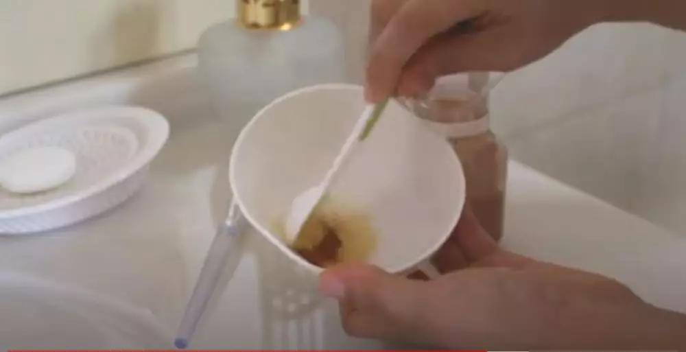 cara atasi jerawat meradang berbagai sumber cara atasi jerawat meradang berbagai sumber