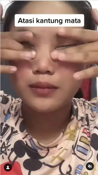 trik atasi kantung mata tanpa pakai eye cream berbagai sumber