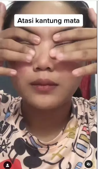 trik atasi kantung mata tanpa pakai eye cream berbagai sumber