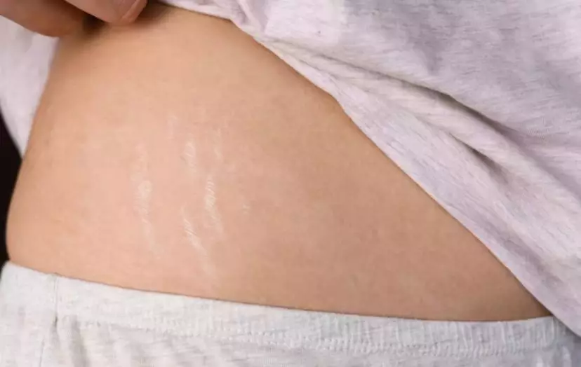 kelebihan pakai almond oil Istimewa kelebihan pakai almond oil Istimewa