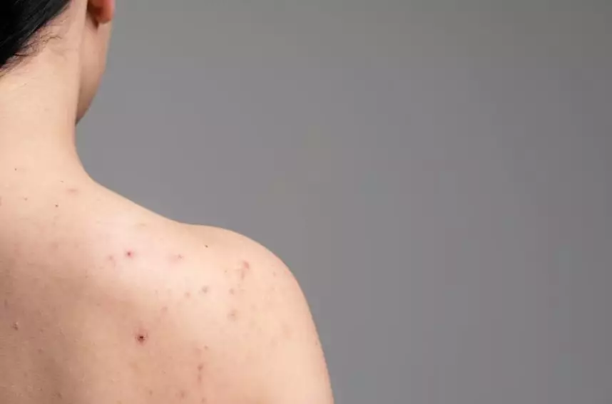 manfaat cetaphil gentle skin cleanser © 2023 brilio.net manfaat cetaphil gentle skin cleanser © 2023 brilio.net