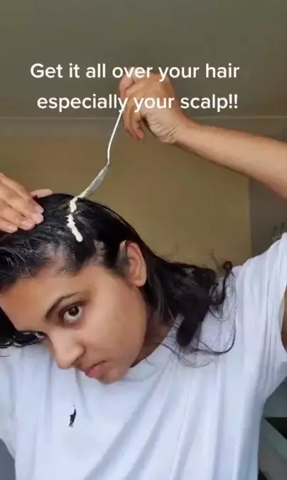 Trik atasi ketombe kering pakai 3 bahan dapur Berbagai sumber