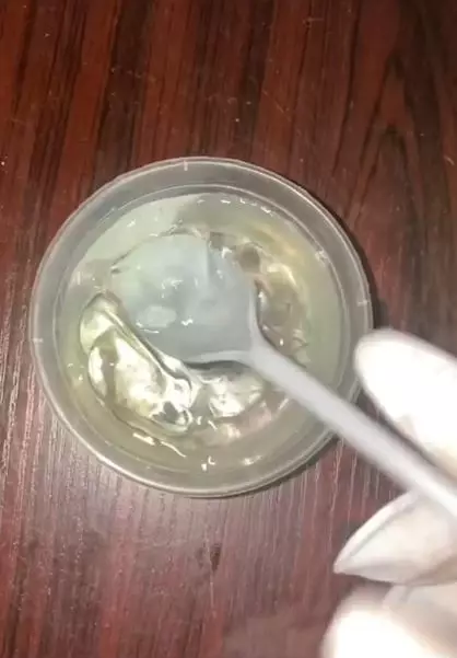 Trik atasi wajah iritasi hanya pakai 2 bahan alami Berbagai sumber