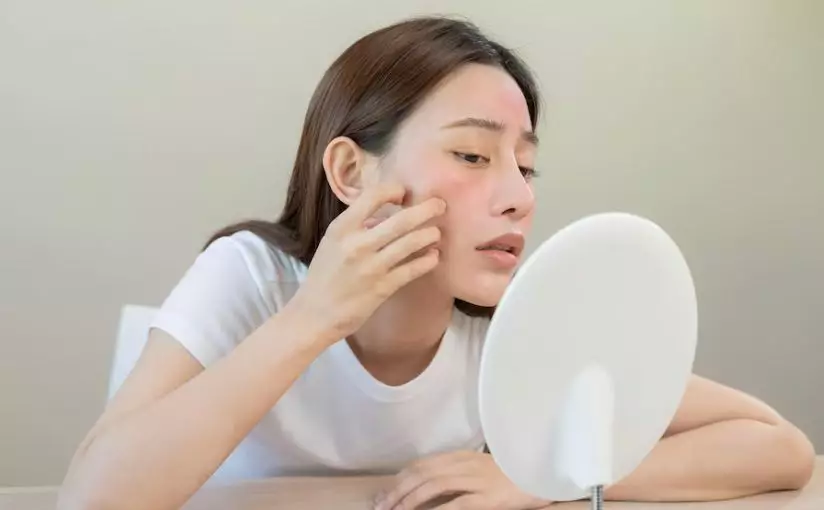 manfaat krim Scarlett Whitening Acne Day & Night Cream © 2023 brilio.net