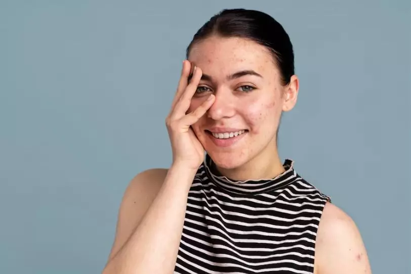 kelebihan pakai minyak argan untuk kecantikan © 2023 brilio.net kelebihan pakai minyak argan untuk kecantikan © 2023 brilio.net