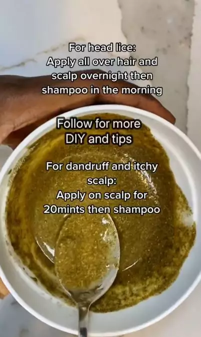 Trik menghilangkan kutu dan atasi ketombe hanya pakai 5 bahan alami Berbagai sumber Trik menghilangkan kutu dan atasi ketombe hanya pakai 5 bahan alami Berbagai sumber