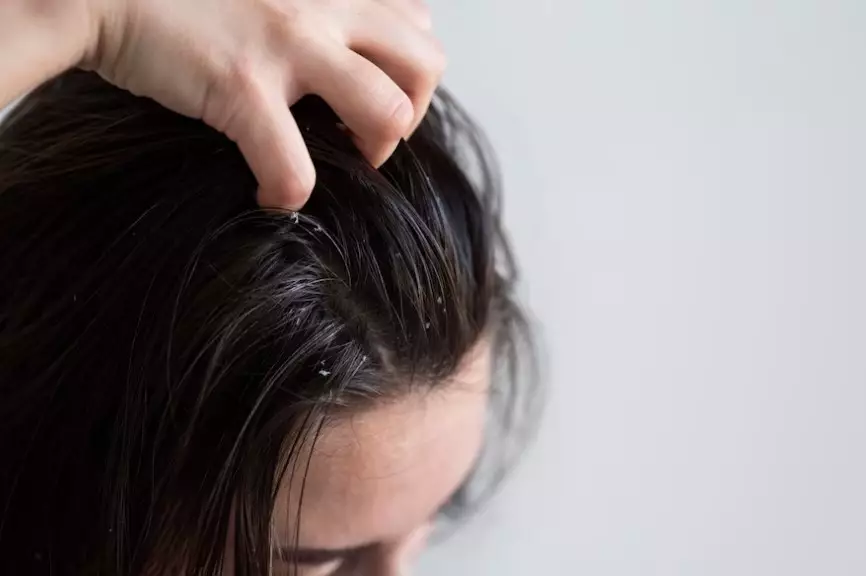 manfaat penggunaan hair powder © 2023 brilio.net