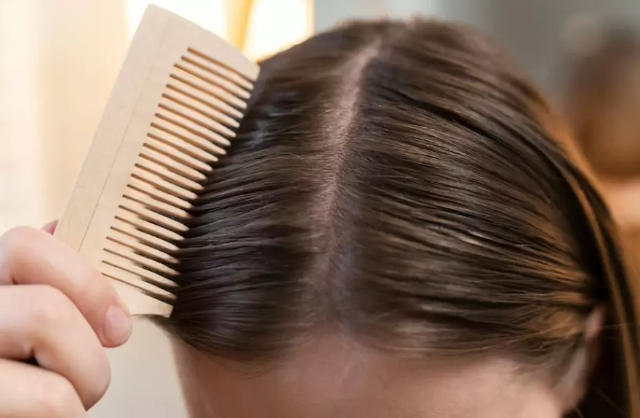 Merawat rambut rontok tanpa ke salon Istimewa Merawat rambut rontok tanpa ke salon Istimewa