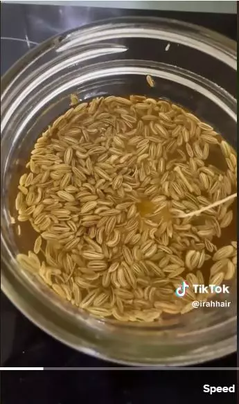 Trik atasi kerontokan pada kulit kepala berbagai sumber Trik atasi kerontokan pada kulit kepala berbagai sumber