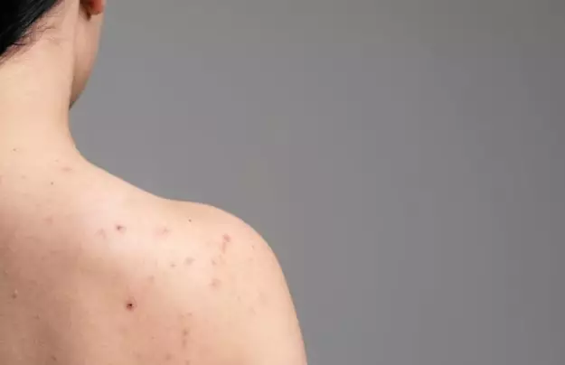 kelebihan lakukan body scrub © 2023 brilio.net