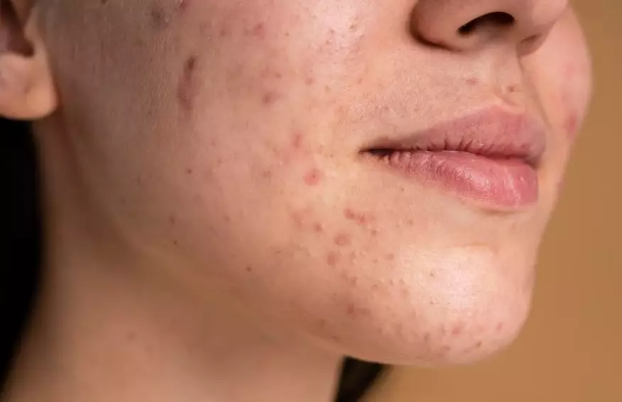 manfaat double cleansing yang jarang diketahui © 2023 brilio.net manfaat double cleansing yang jarang diketahui © 2023 brilio.net