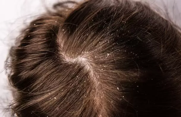 manfaat buah bit untuk kecantikan © 2023 brilio.net