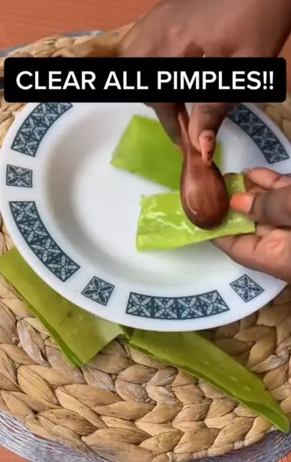 Trik mengempiskan jerawat membandel cuma pakai 2 bahan alami Berbagai sumber Trik mengempiskan jerawat membandel cuma pakai 2 bahan alami Berbagai sumber