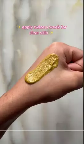 Cara hilangkan noda hitam pada wajah  berbagai sumber Cara hilangkan noda hitam pada wajah  berbagai sumber