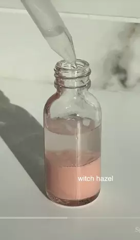  trik atasi jerawat berbagai sumber