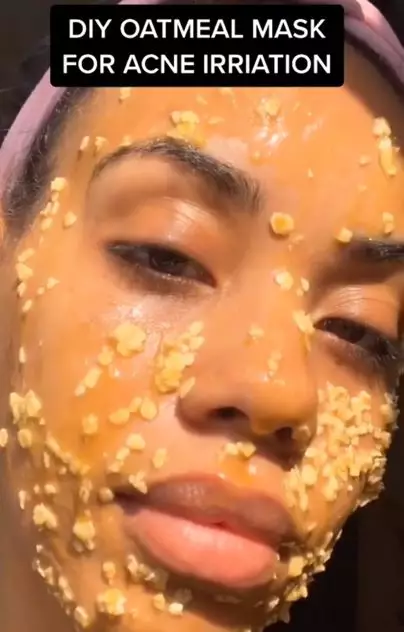 Trik merawat wajah iritasi akibat jerawat pakai masker dari 3 bahan dapur Berbagai sumber