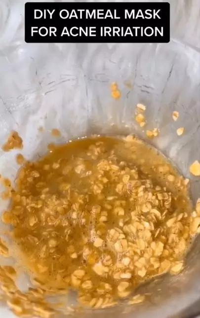 Trik merawat wajah iritasi akibat jerawat pakai masker dari 3 bahan dapur Berbagai sumber