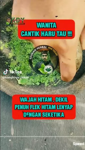 Trik hilangkan bintik hitam cuma pakai masker berbagai sumber
