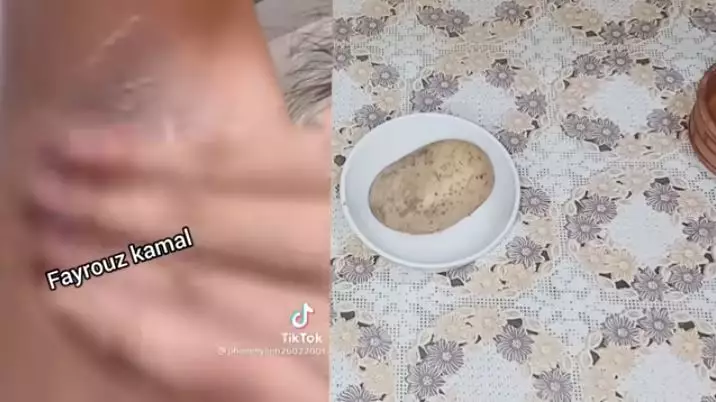 cara mencerahkan ketiak hitam hanya pakai 1 jenis sayuran berbagai sumber  cara mencerahkan ketiak hitam hanya pakai 1 jenis sayuran berbagai sumber