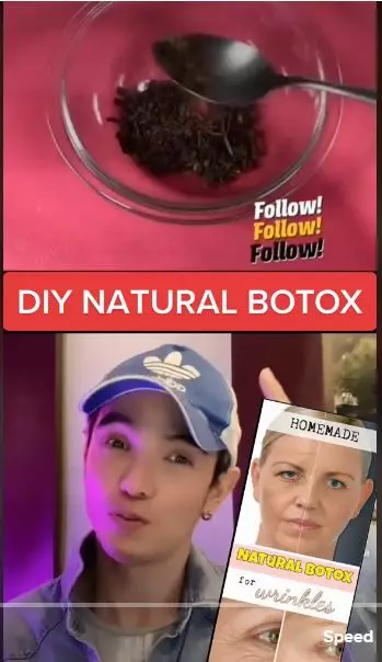 trik membuat botoks alami dari 1 bahan rempah berbagai sumber  trik membuat botoks alami dari 1 bahan rempah berbagai sumber