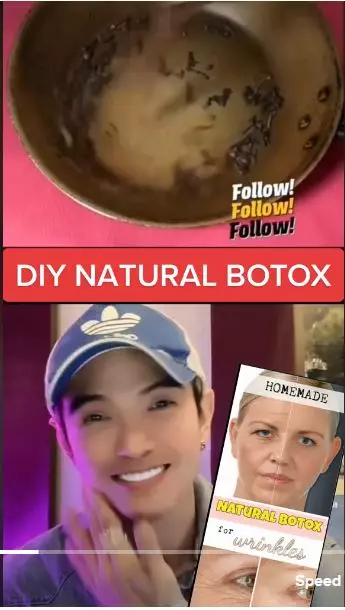 trik membuat botoks alami dari 1 bahan rempah berbagai sumber  trik membuat botoks alami dari 1 bahan rempah berbagai sumber