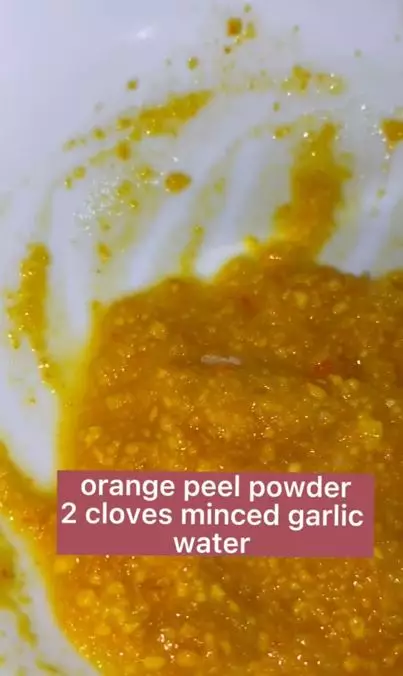 Trik atasi ketombe akibat rambut kepala kering cuma butuh 1 jenis kulit buah Berbagai sumber Trik atasi ketombe akibat rambut kepala kering cuma butuh 1 jenis kulit buah Berbagai sumber