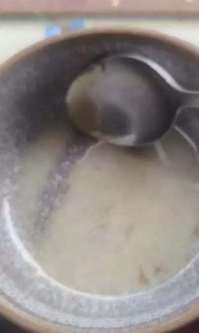 Trik membuat masker untuk atasi keriput sekitar mata pakai 2 bahan alami Berbagai sumber