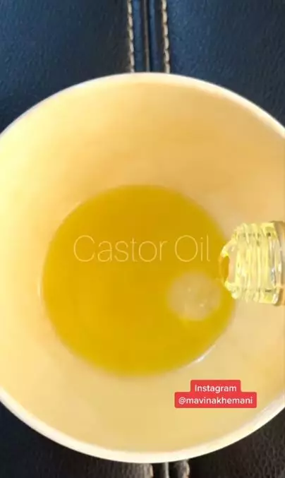 Cara menumbuhkan rambut pitak area dahi pakai 3 jenis minyak Berbagai sumber Cara menumbuhkan rambut pitak area dahi pakai 3 jenis minyak Berbagai sumber