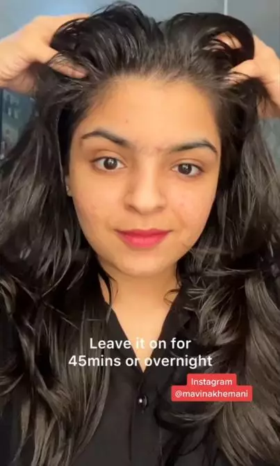 Cara menumbuhkan rambut pitak area dahi pakai 3 jenis minyak Berbagai sumber Cara menumbuhkan rambut pitak area dahi pakai 3 jenis minyak Berbagai sumber