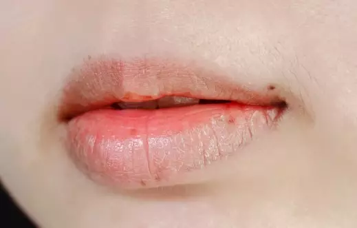 kelebihan pakai minyak lavender untuk kecantikan © 2023 brilio.net kelebihan pakai minyak lavender untuk kecantikan © 2023 brilio.net