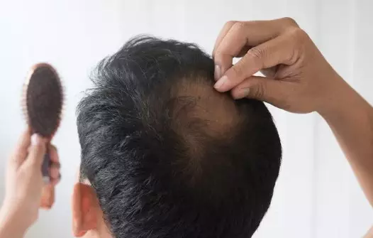 kelebihan pakai minyak lavender untuk kecantikan © 2023 brilio.net kelebihan pakai minyak lavender untuk kecantikan © 2023 brilio.net