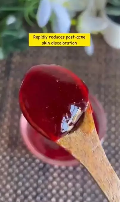 Cara mengatasi jerawat dan bekasnya pakai 1 jenis umbi-umbian Berbagai sumber