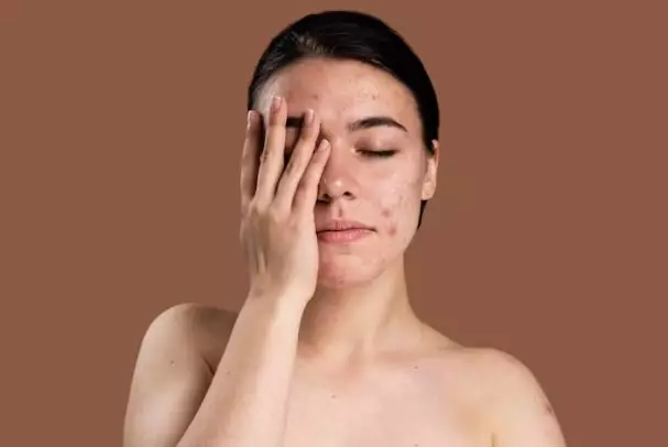 Kelebihan daun murbei untuk kecantikan © 2023 berbagai sumber Kelebihan daun murbei untuk kecantikan © 2023 berbagai sumber