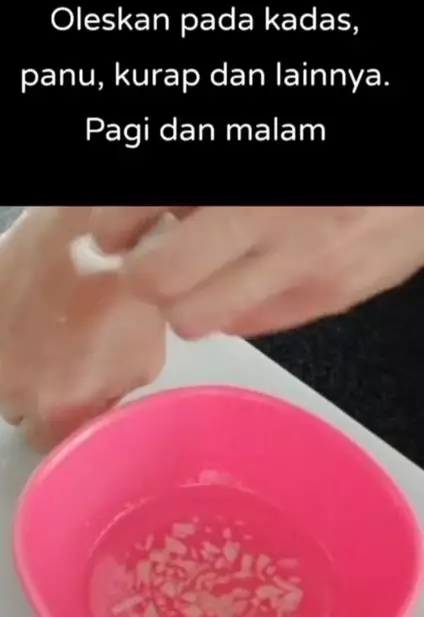 Cara mengatasi eksim menahun hanya dengan 1 bumbu dapur Berbagai sumber