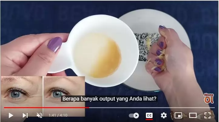 Bantu hilangkan kerutan di area mata berbagai sumber