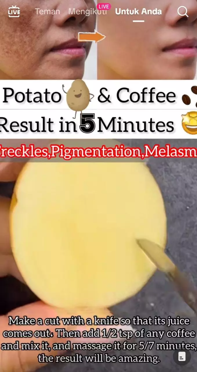 trik samarkan bintik hitam © 2023 brilio.net