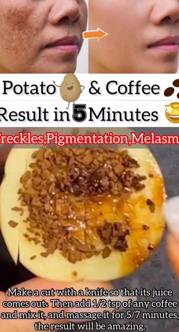 trik samarkan bintik hitam © 2023 brilio.net