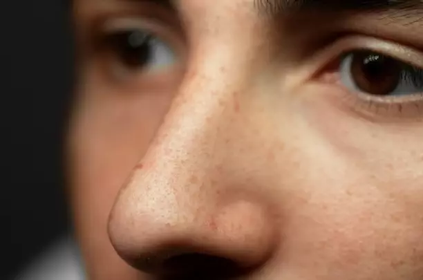 kelebihan daun kunyit untuk kecantikan © 2023 brilio.net kelebihan daun kunyit untuk kecantikan © 2023 brilio.net