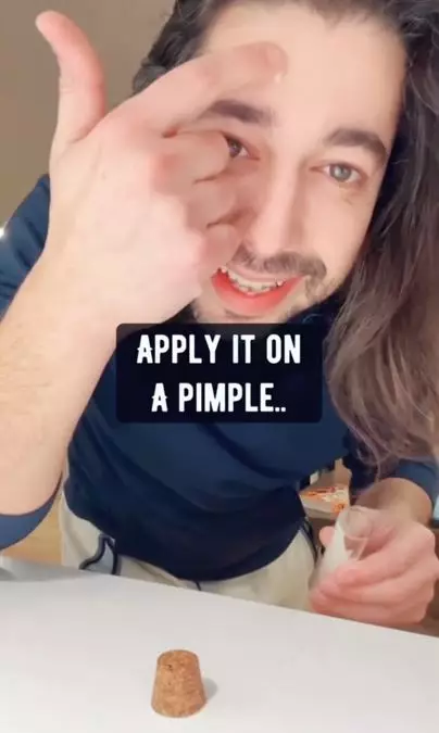 Cara mengatasi jerawat batu membandel pakai 1 bahan pemanis Berbagai sumber
