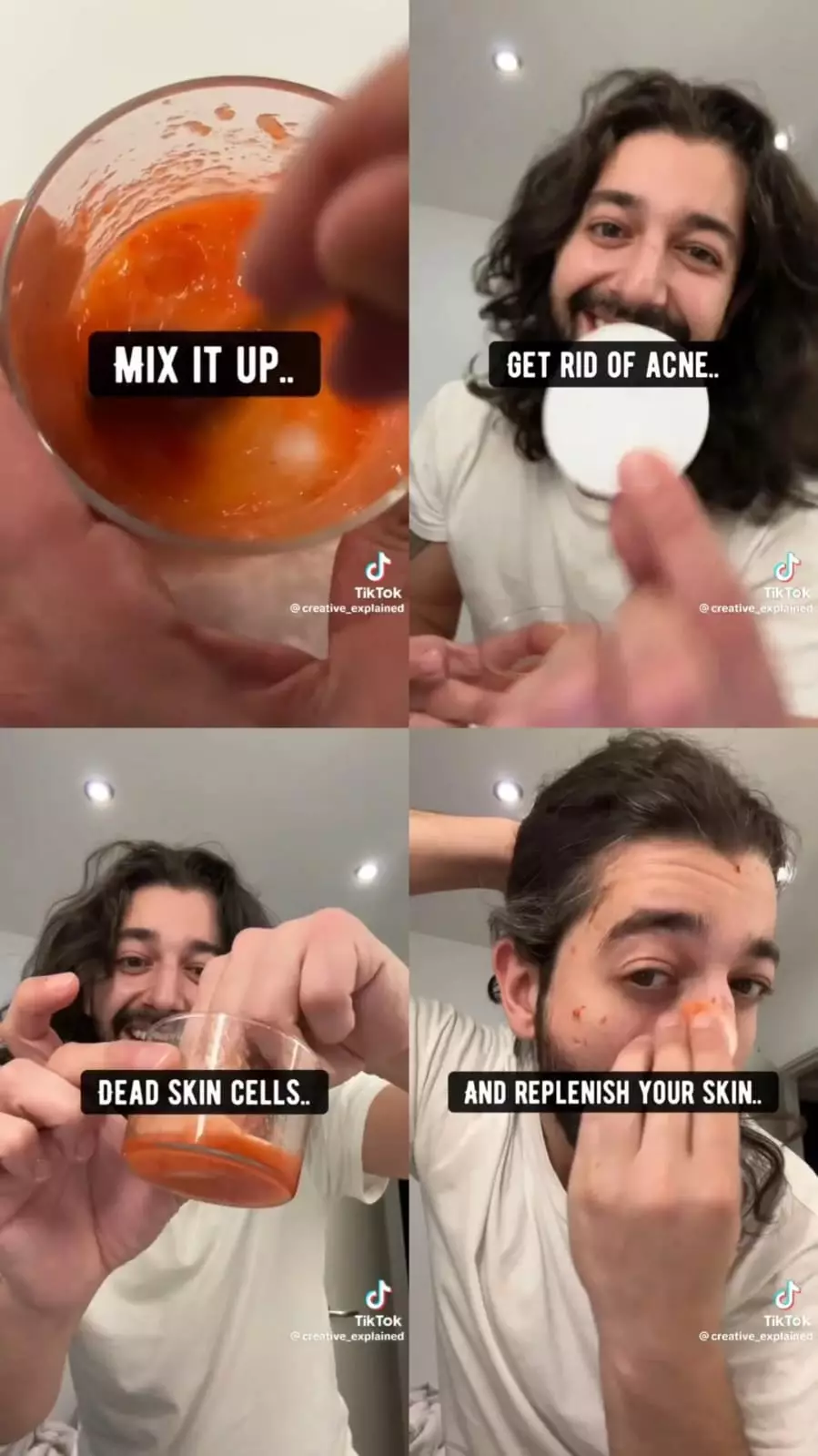 begini cara menghilangkan jerawat © Instagram