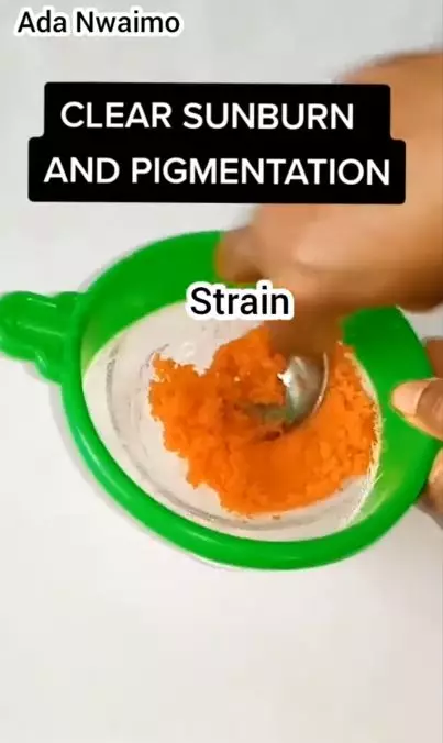 Trik mengatasi sunburn pada wajah pakai 1 jenis sayur Berbagai sumber